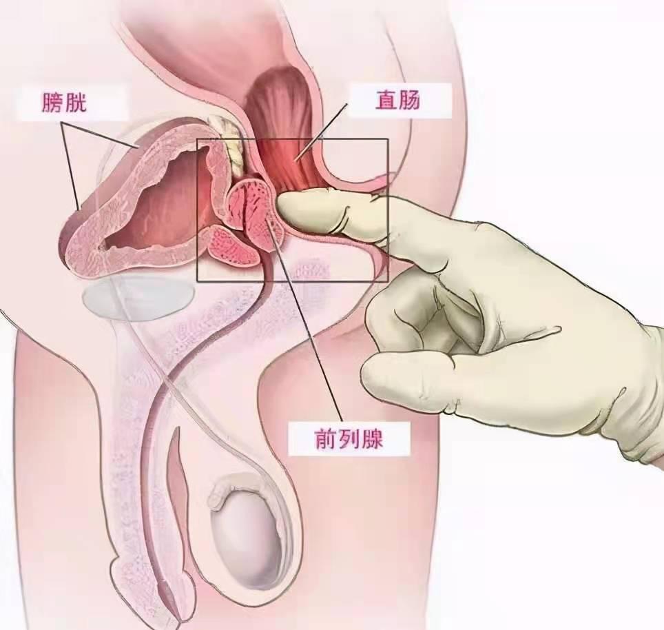 女性常见十大癌症2025年排名前十名榜单出炉